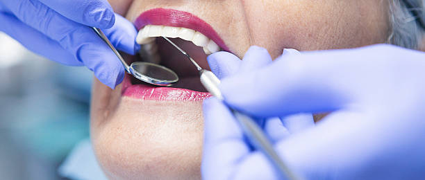 Best Emergency Root Canal Treatment in Felton, DE